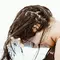 Cuaca Panas dan Lembap Bikin Ketombe Makin Parah
