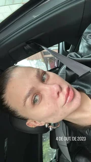 Flávia Pavanelli revela motivo de cicatrizes nas mãos após foto