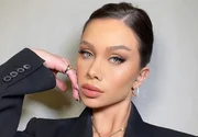 Flávia Pavanelli revela motivo de cicatrizes nas mãos após foto
