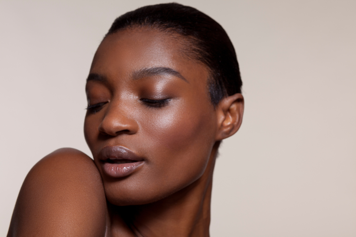 Melasma: saiba diferenciar os 3 tipos da doença e a melhor forma de tratar