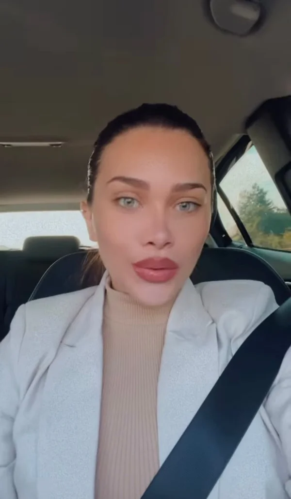 Flávia Pavanelli revela motivo de cicatrizes nas mãos após foto
