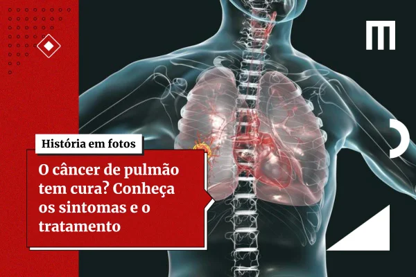 Anvisa autoriza novo medicamento contra câncer de pulmão avançado
