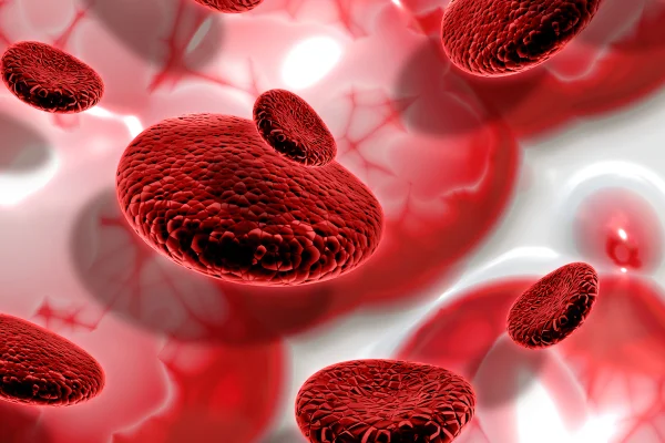 Hematologista alerta que anemia não tratada pode sobrecarregar o coração